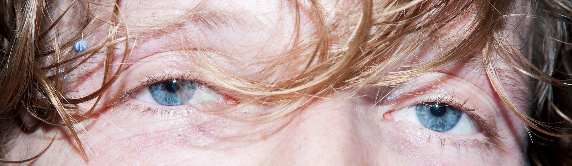 Cocaine, Ket, Pills and More This Is What Your Eyes Look Like When You